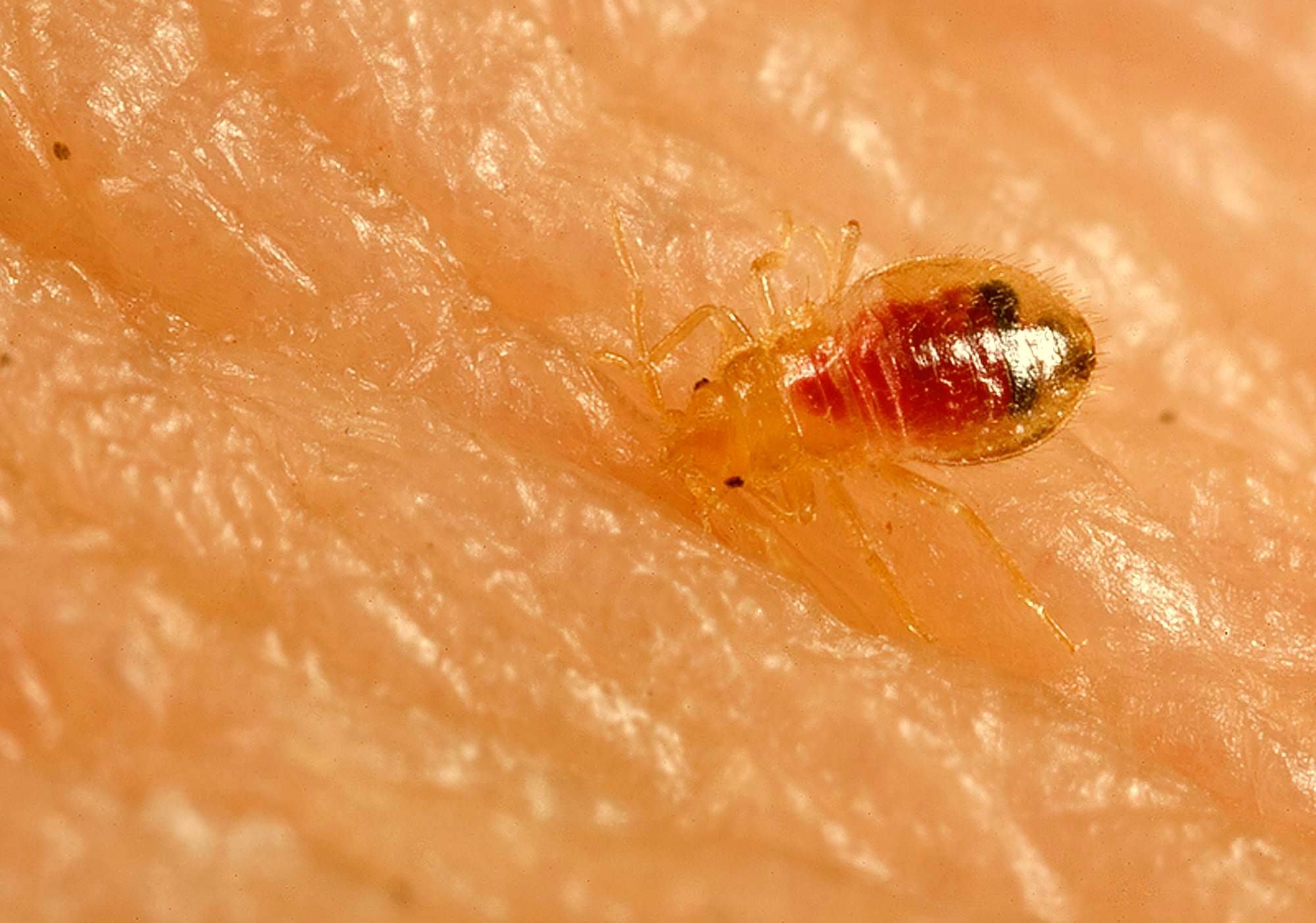 Bed bug Bite-Pictures, Symptoms, Treatment
